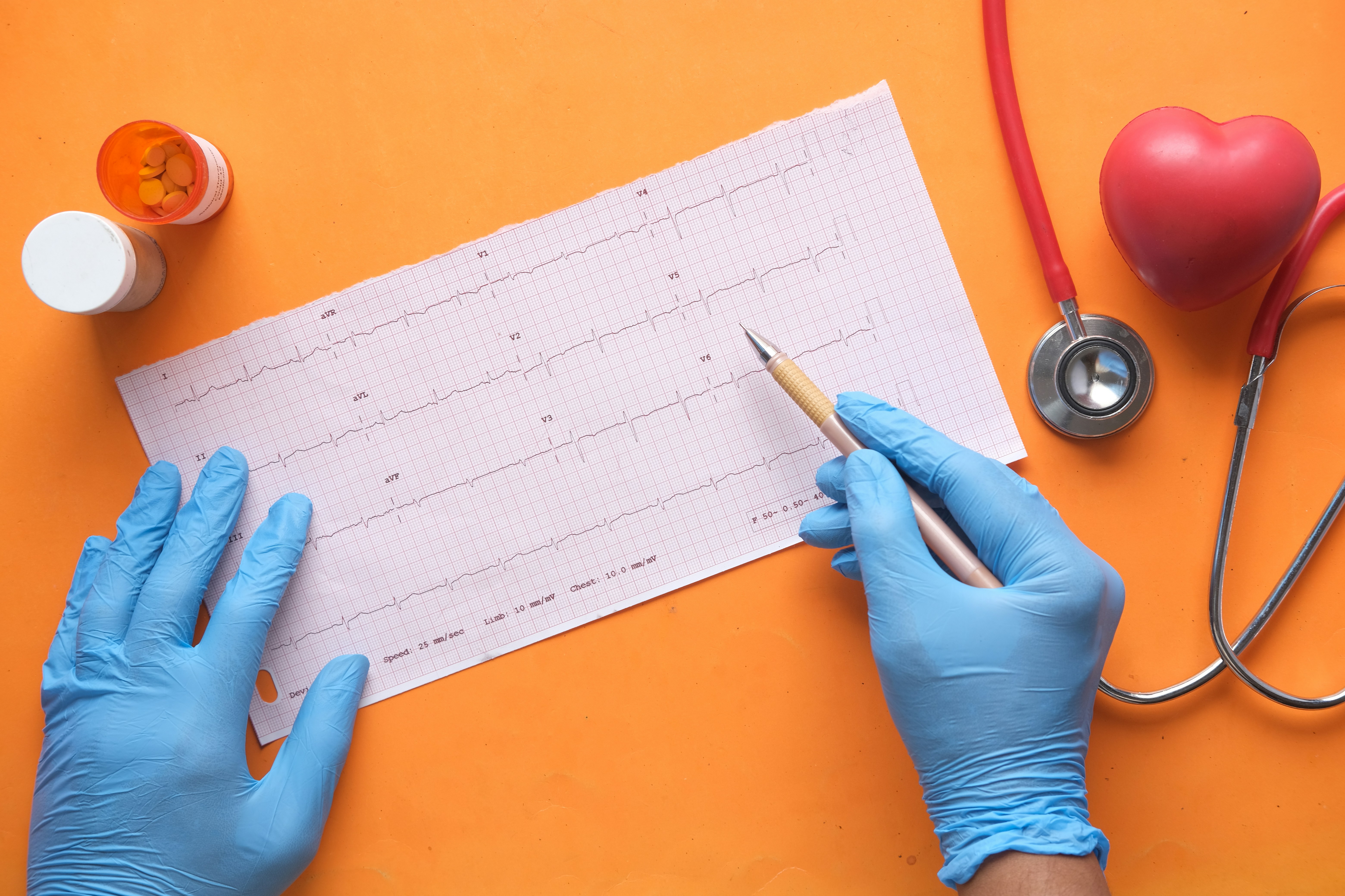 ECG (Electrocardiogram)